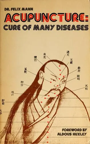 Acupuncture — 