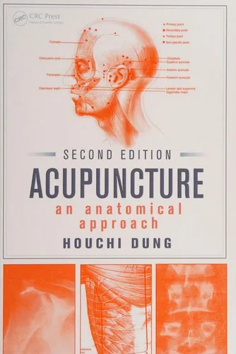 Acupuncture — 