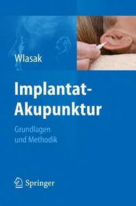 Implantat-Akupunktur