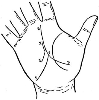 Plate XIII. THE LINE OF DESTINY AND ITS MODIFICATIONS.