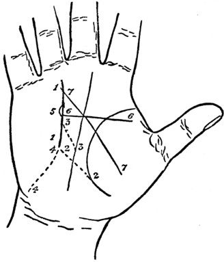 Plate XV. THE LINE OF SUN AND ITS MODIFICATIONS.