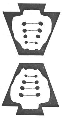 Sacrum bone and inverted sacrum